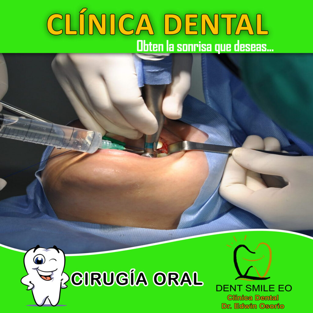 cirugia-oral