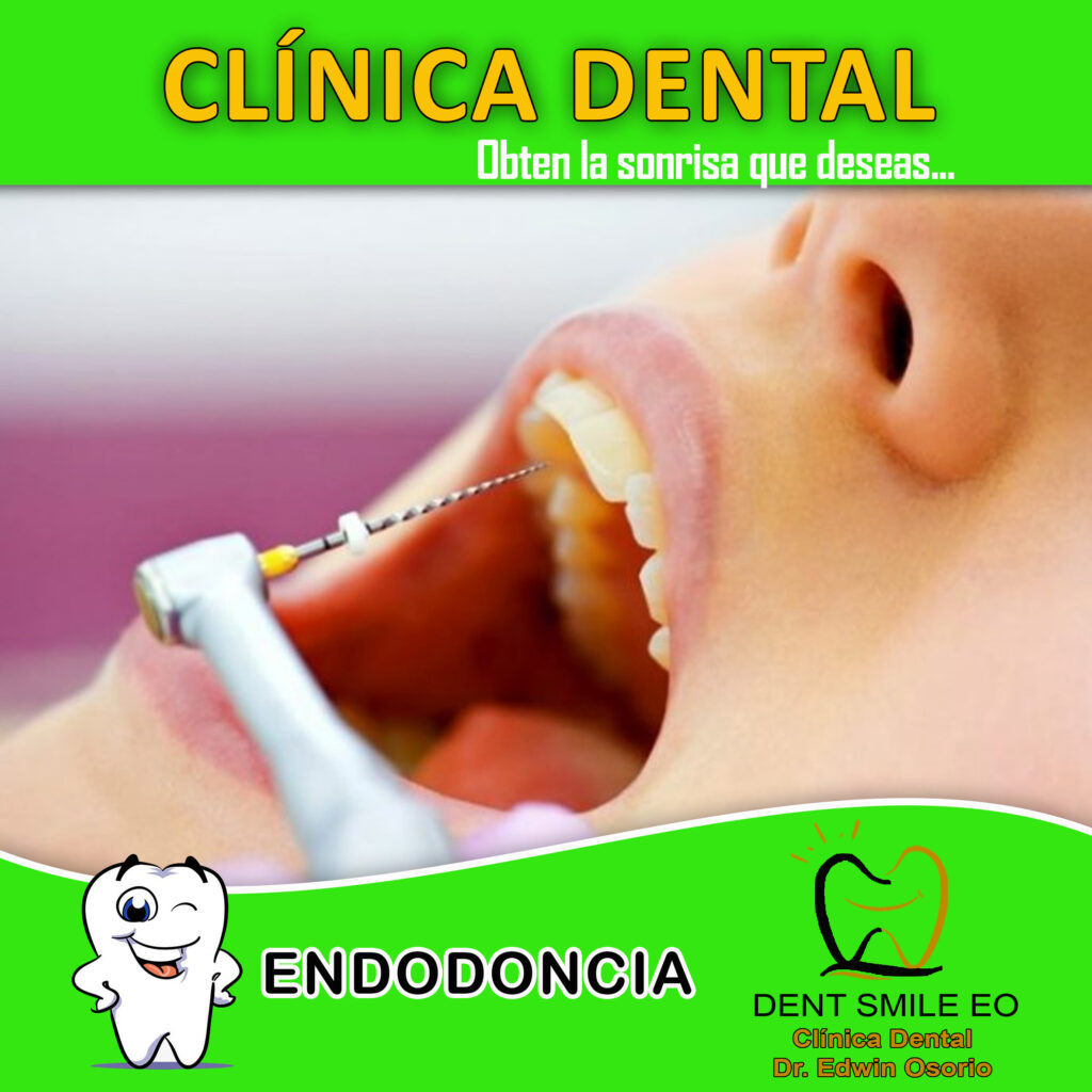 endodoncia